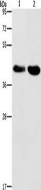 Serine/Threonine Kinase 17a antibody, TA351146, Origene, Western Blot image 