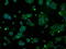 ATP Synthase F1 Subunit Beta antibody, GTX84841, GeneTex, Immunofluorescence image 
