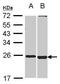 Spermatogenesis And Oogenesis Specific Basic Helix-Loop-Helix 2 antibody, PA5-30658, Invitrogen Antibodies, Western Blot image 