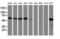 Sequestosome 1 antibody, LS-C172379, Lifespan Biosciences, Western Blot image 