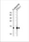 Fatty Acid Binding Protein 4 antibody, TA328110, Origene, Western Blot image 