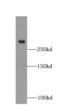FBN2 antibody, FNab03116, FineTest, Western Blot image 