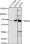 Nucleolar Complex Associated 4 Homolog antibody, A15509, ABclonal Technology, Western Blot image 