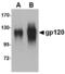 HIV gp120 antibody, LS-C83913, Lifespan Biosciences, Western Blot image 