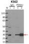 Proteasome Subunit Alpha 1 antibody, PA1-963, Invitrogen Antibodies, Immunoprecipitation image 