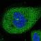 Chromosome 6 Open Reading Frame 62 antibody, NBP1-90533, Novus Biologicals, Immunocytochemistry image 