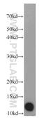 Death-inducer obliterator 1 antibody, 11790-1-AP, Proteintech Group, Western Blot image 