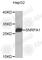 Small Nuclear Ribonucleoprotein Polypeptide A' antibody, A4119, ABclonal Technology, Western Blot image 