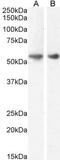 Glucagon-like peptide 1 receptor antibody, GTX17606, GeneTex, Western Blot image 