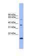 Notch Receptor 4 antibody, orb329987, Biorbyt, Western Blot image 