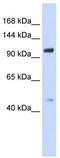 Transient Receptor Potential Cation Channel Subfamily C Member 4 antibody, TA338575, Origene, Western Blot image 
