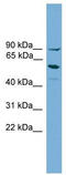 Arachidonate 15-Lipoxygenase Type B antibody, TA346277, Origene, Western Blot image 