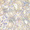 DLC1 Rho GTPase Activating Protein antibody, A1921, ABclonal Technology, Immunohistochemistry paraffin image 