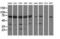 Pseudouridine Synthase 7 antibody, LS-C115708, Lifespan Biosciences, Western Blot image 