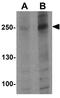 Autophagy Related 2B antibody, GTX32090, GeneTex, Western Blot image 
