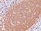 CD20 antibody, NBP2-48358, Novus Biologicals, Immunohistochemistry paraffin image 