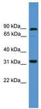 Atonal BHLH Transcription Factor 8 antibody, TA345461, Origene, Western Blot image 