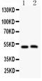 Major Intrinsic Protein Of Lens Fiber antibody, GTX12335, GeneTex, Western Blot image 