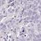 Adaptor Related Protein Complex 5 Subunit Mu 1 antibody, HPA055768, Atlas Antibodies, Immunohistochemistry frozen image 