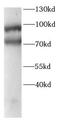 Galactosidase Beta 1 antibody, FNab10432, FineTest, Western Blot image 