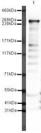 FAS antibody, PA5-19509, Invitrogen Antibodies, Western Blot image 