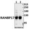 RAN Binding Protein 17 antibody, A12420-1, Boster Biological Technology, Western Blot image 