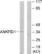 Ankyrin repeat domain-containing protein 1 antibody, abx013619, Abbexa, Western Blot image 