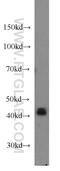 Eukaryotic translation initiation factor 3 subunit M antibody, 66025-1-Ig, Proteintech Group, Western Blot image 