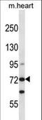Myosin Light Chain Kinase 3 antibody, LS-C164492, Lifespan Biosciences, Western Blot image 