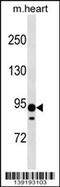 Xylosyltransferase 2 antibody, 60-352, ProSci, Western Blot image 
