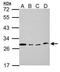 LOR antibody, PA5-34945, Invitrogen Antibodies, Western Blot image 
