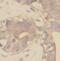 Paxillin antibody, FNab06179, FineTest, Immunohistochemistry frozen image 
