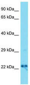 DnaJ Heat Shock Protein Family (Hsp40) Member C12 antibody, TA344721, Origene, Western Blot image 