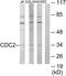 Cyclin Dependent Kinase 1 antibody, TA326259, Origene, Western Blot image 