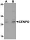 Centromere Protein O antibody, NBP1-76240, Novus Biologicals, Western Blot image 