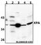 XPA, DNA Damage Recognition And Repair Factor antibody, A01182-3, Boster Biological Technology, Western Blot image 