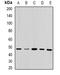 Ubiquinol-Cytochrome C Reductase Core Protein 2 antibody, orb340875, Biorbyt, Western Blot image 