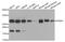 Proteasome Subunit Alpha 5 antibody, TA332887, Origene, Western Blot image 