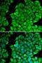 Cyclin D2 antibody, LS-B13861, Lifespan Biosciences, Immunofluorescence image 