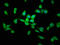 Lysosomal-associated transmembrane protein 4B antibody, LS-C674302, Lifespan Biosciences, Immunofluorescence image 
