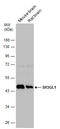 SH3 Domain Containing GRB2 Like 1, Endophilin A2 antibody, GTX133339, GeneTex, Western Blot image 