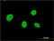 Nucleolar Protein 4 antibody, H00008715-M01, Novus Biologicals, Immunocytochemistry image 