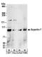 Exportin For TRNA antibody, A303-972A, Bethyl Labs, Western Blot image 