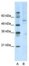 Cyclic AMP-dependent transcription factor ATF-7 antibody, TA343639, Origene, Western Blot image 