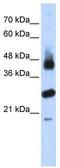 F-Box And Leucine Rich Repeat Protein 2 antibody, TA329813, Origene, Western Blot image 