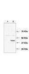 Ubiquitin Conjugating Enzyme E2 J1 antibody, TA319235, Origene, Western Blot image 