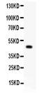 P2X purinoceptor 5 antibody, PB9305, Boster Biological Technology, Western Blot image 