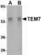 Plexin Domain Containing 1 antibody, AHP1624, Bio-Rad (formerly AbD Serotec) , Western Blot image 