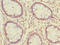 Methionine-R-sulfoxide reductase B2, mitochondrial antibody, LS-C676078, Lifespan Biosciences, Immunohistochemistry paraffin image 