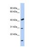 Cytochrome C Oxidase Assembly Factor COX18 antibody, NBP1-59616, Novus Biologicals, Western Blot image 